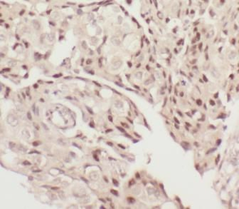 CARM1 Rabbit Polyclonal Antibody