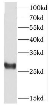CSNK2B Antibody