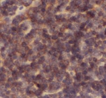 CASP1 Antibody