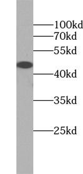 CASP4 Rabbit Polyclonal Antibody