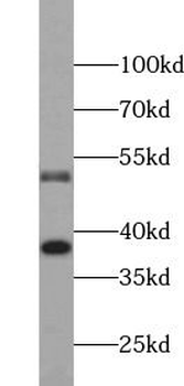 CASP8 Antibody