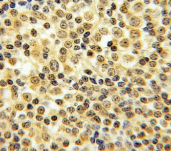 CASP8 Antibody