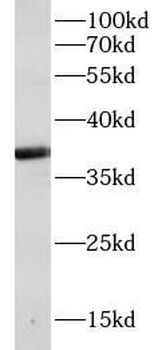 CTSK Antibody