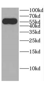 CBLL1 Antibody