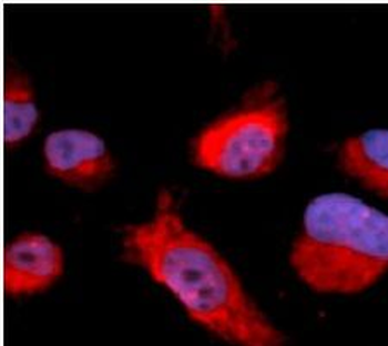 CBS Rabbit Polyclonal Antibody