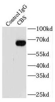 CBS Rabbit Polyclonal Antibody
