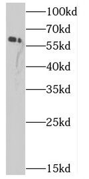 CBS Rabbit Polyclonal Antibody