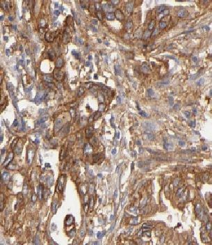 CBS Rabbit Polyclonal Antibody