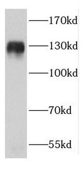 CC2D1A Rabbit Polyclonal Antibody