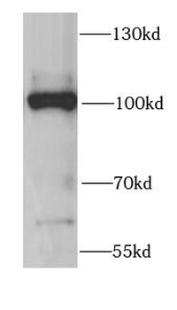 CCAR2 Antibody