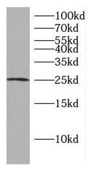 CCDC25 Rabbit Polyclonal Antibody