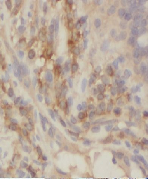 CCDC93 Rabbit Polyclonal Antibody