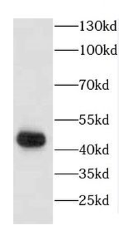 CCR5 Antibody