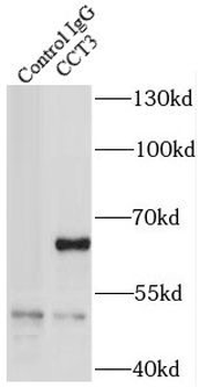 CCT3 Rabbit Polyclonal Antibody