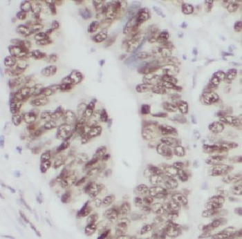 CCT3 Rabbit Polyclonal Antibody
