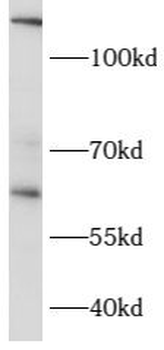 CCT6B Rabbit Polyclonal Antibody
