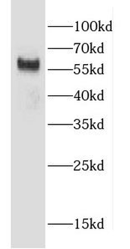 CCZ1 Rabbit Polyclonal Antibody