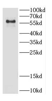 IL7R Antibody