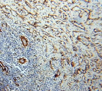 MCAM Rabbit Polyclonal Antibody