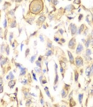 CD151 Rabbit Polyclonal Antibody