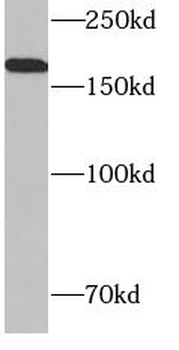 CD206 Antibody