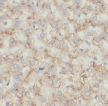 CD206 Antibody