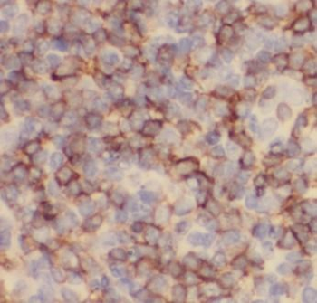 CD23 Rabbit Polyclonal Antibody