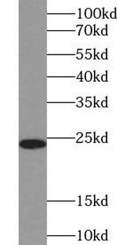 CD3D Mouse Monoclonal Antibody