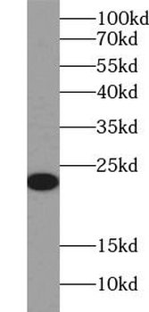 CD3E Rabbit Polyclonal Antibody