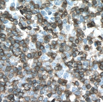 CD3E Rabbit Polyclonal Antibody