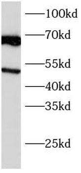 CD320 Rabbit Polyclonal Antibody
