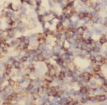 CD320 Rabbit Polyclonal Antibody