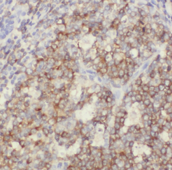 CD37 Rabbit Polyclonal Antibody