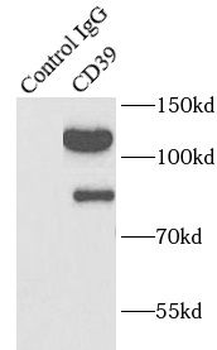 ENTPD1 Rabbit Polyclonal Antibody