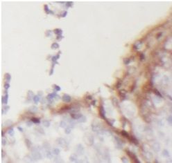 ENTPD1 Rabbit Polyclonal Antibody