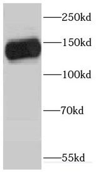 GP1BA Rabbit Polyclonal Antibody