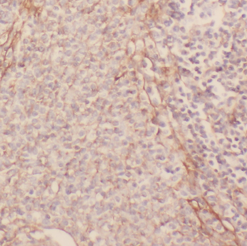 GP1BA Rabbit Polyclonal Antibody