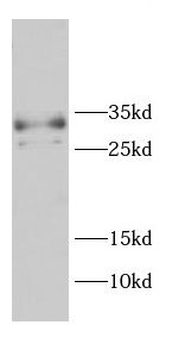 CD99 Rabbit Polyclonal Antibody