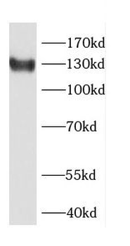 CDAN1 Rabbit Polyclonal Antibody