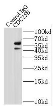 CDC25B Rabbit Polyclonal Antibody
