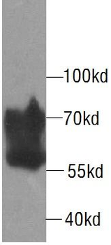 CDC25B Rabbit Polyclonal Antibody