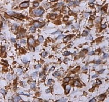 CDC25B Rabbit Polyclonal Antibody
