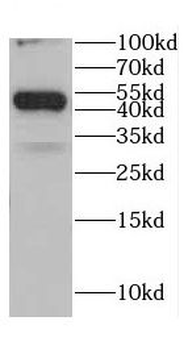 CDC42EP4 Rabbit Polyclonal Antibody