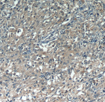 CDCA3 Antibody