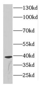 CDCA8 Rabbit Polyclonal Antibody