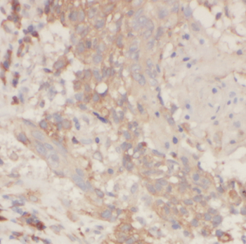 CDCA8 Rabbit Polyclonal Antibody