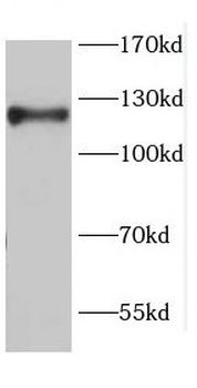CDH17 Rabbit Polyclonal Antibody