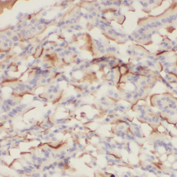 CDH17 Rabbit Polyclonal Antibody