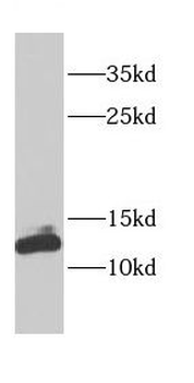 CDK2AP1 Rabbit Polyclonal Antibody