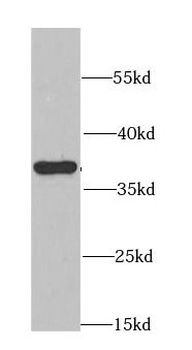CDK6 Antibody